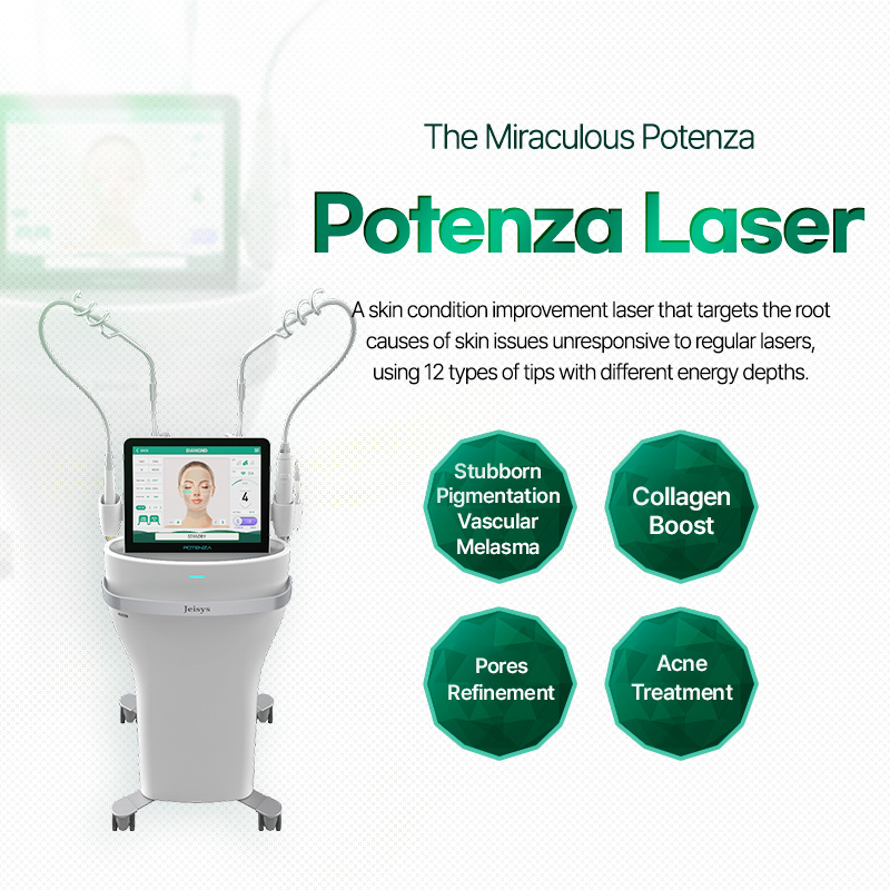 Potenza Laser - VandS Suji