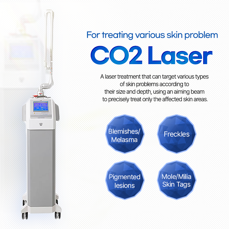 CO2 Laser - VandS Suji