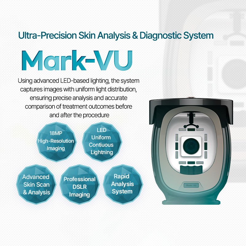 Mark-VU - VandS Suji
